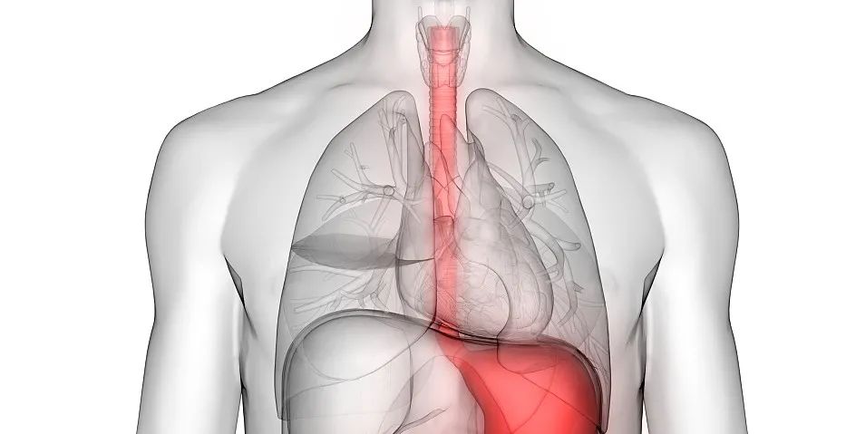 一文帶你了解食管癌放療，食管癌什么情況選擇放療？