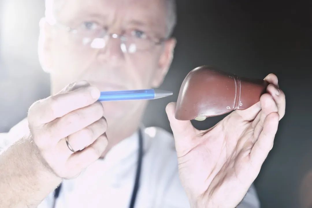 肝癌死亡率“悄悄”增加，原因竟然不是乙肝病毒！