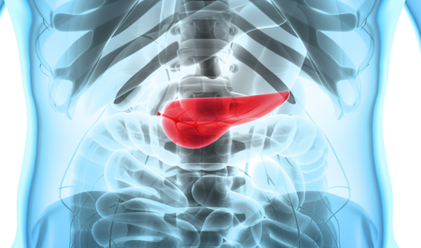 抓住“胰腺生機(jī)”！多項(xiàng)創(chuàng)新療法為晚期胰腺癌患者帶來(lái)生存希望