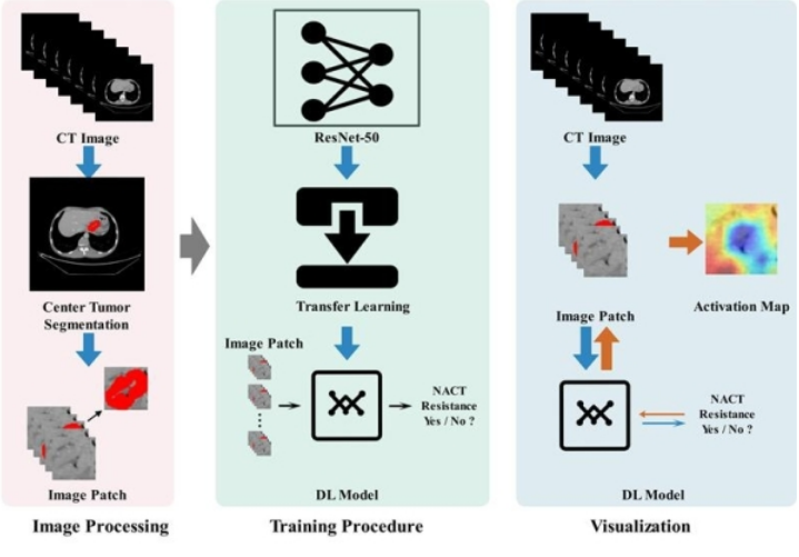Gastric Cancer：深度學(xué)習(xí)模型預(yù)測(cè)進(jìn)展期胃癌新輔助化療療效