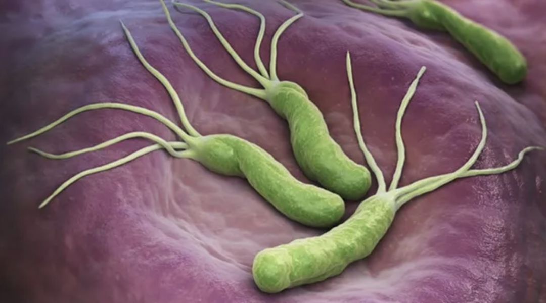 是時(shí)候根除一下了！頂刊發(fā)文：根除幽門(mén)螺旋桿菌可使胃癌風(fēng)險(xiǎn)降低50%！