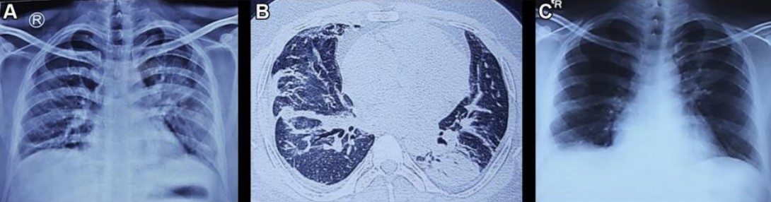 1672843121583005.jpg 圖1.jpg